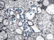 新型コロナウイルス 顕微鏡 画像