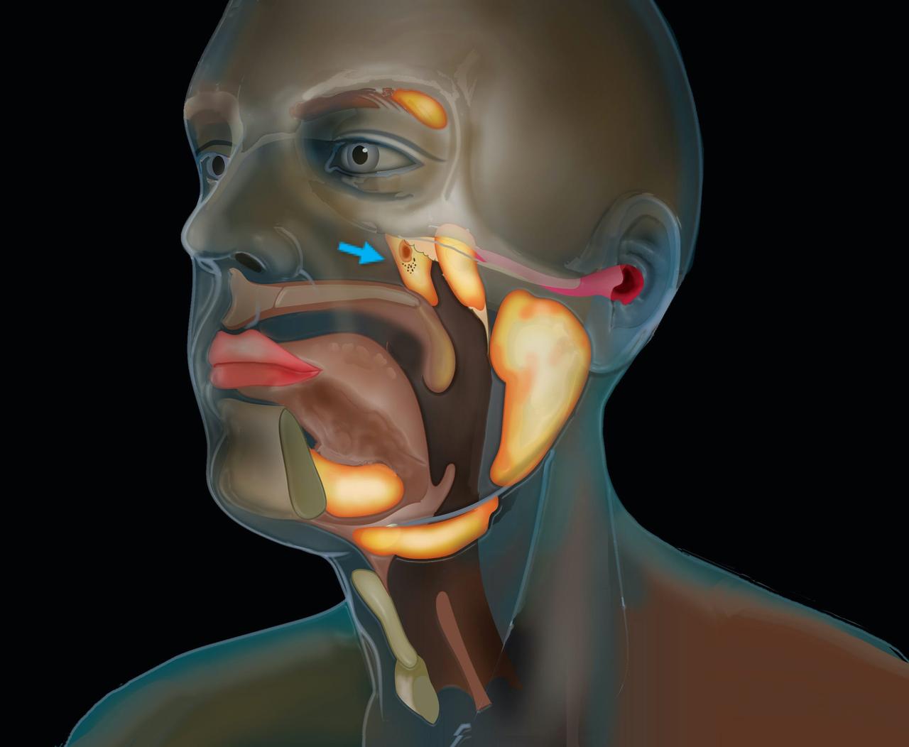 管状腺は鼻腔と咽頭の交差部に位置する。