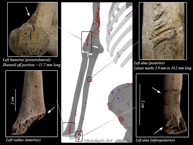 世界最古のサメ被害者、100年間謎だった｢縄文人の死因｣3Dモデリングで究明。 | Business Insider Japan