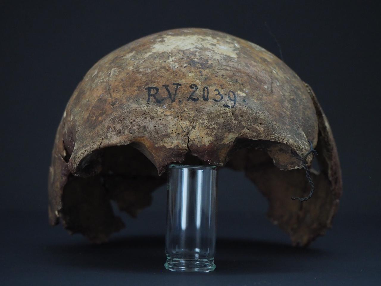 ラトビアのリンニュカルンスで埋葬されていた男性の頭蓋骨の一部。この男性は、約5000年前に、のちのペストに類似する感染症が原因で亡くなった可能性がある。