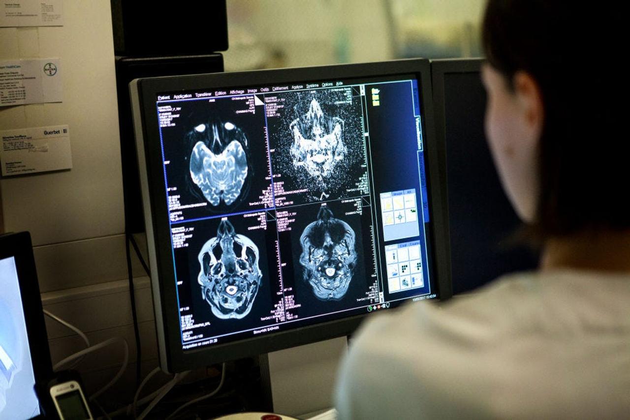 脳のMRI画像を見る医療従事者。フランス・サヴォワの病院で。