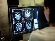 脳のMRI画像を見る医療従事者。フランス・サヴォワの病院で。