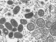 CDCによるサル痘ウイルスの顕微鏡画像。