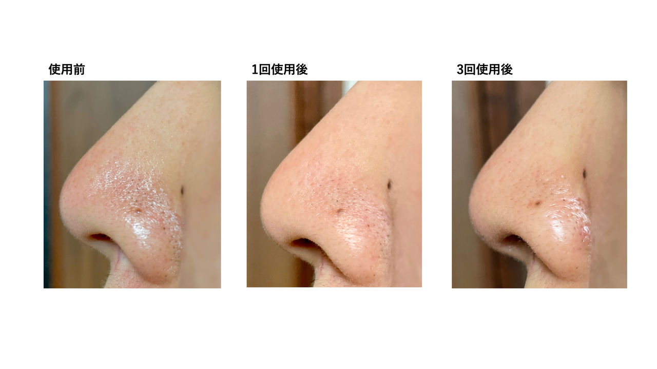 2b530e80c7d0de90885e285c5d798063