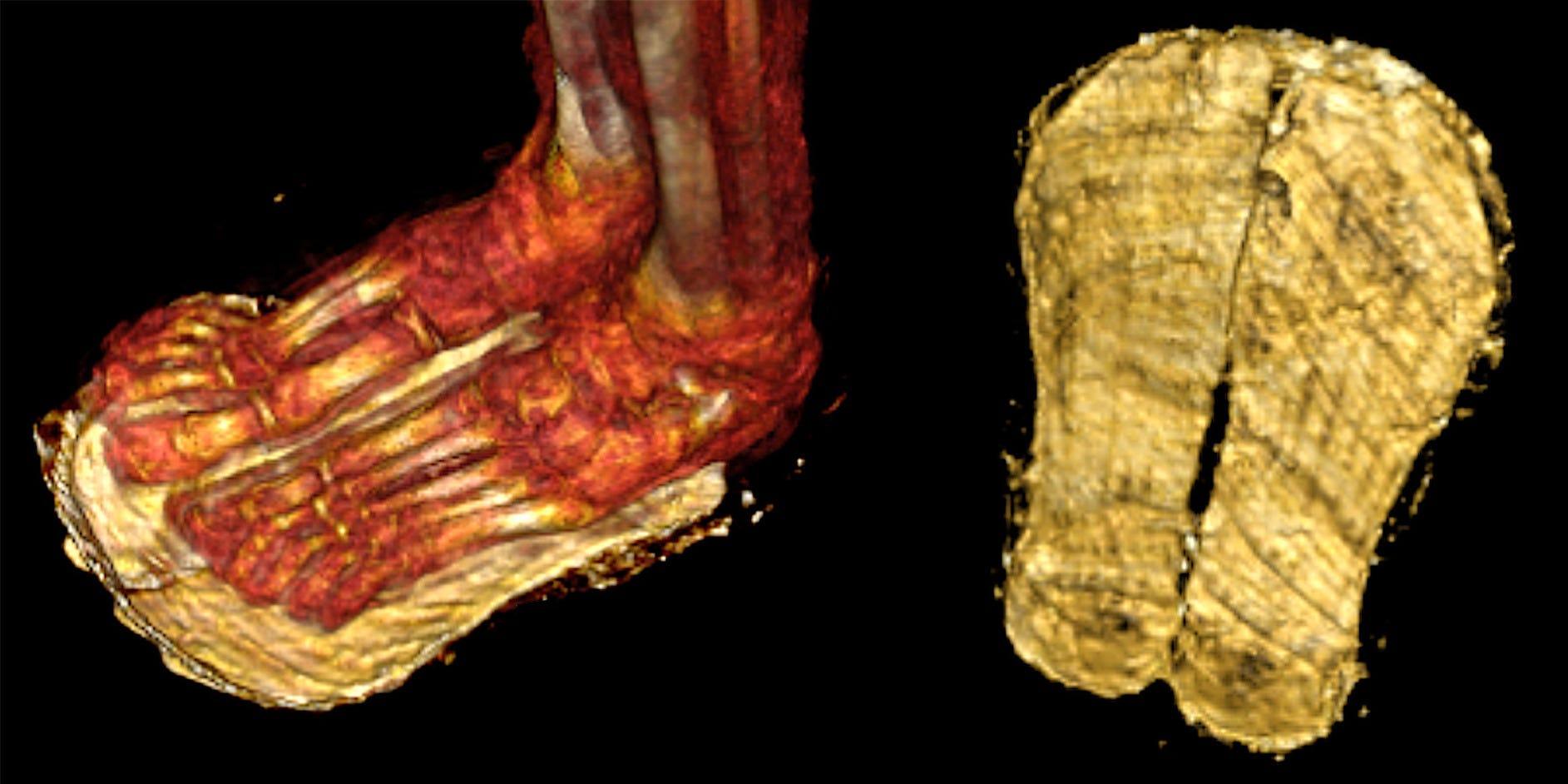 2300年前の少年のミイラから49個の護符を発見…｢黄金の舌｣や｢心臓