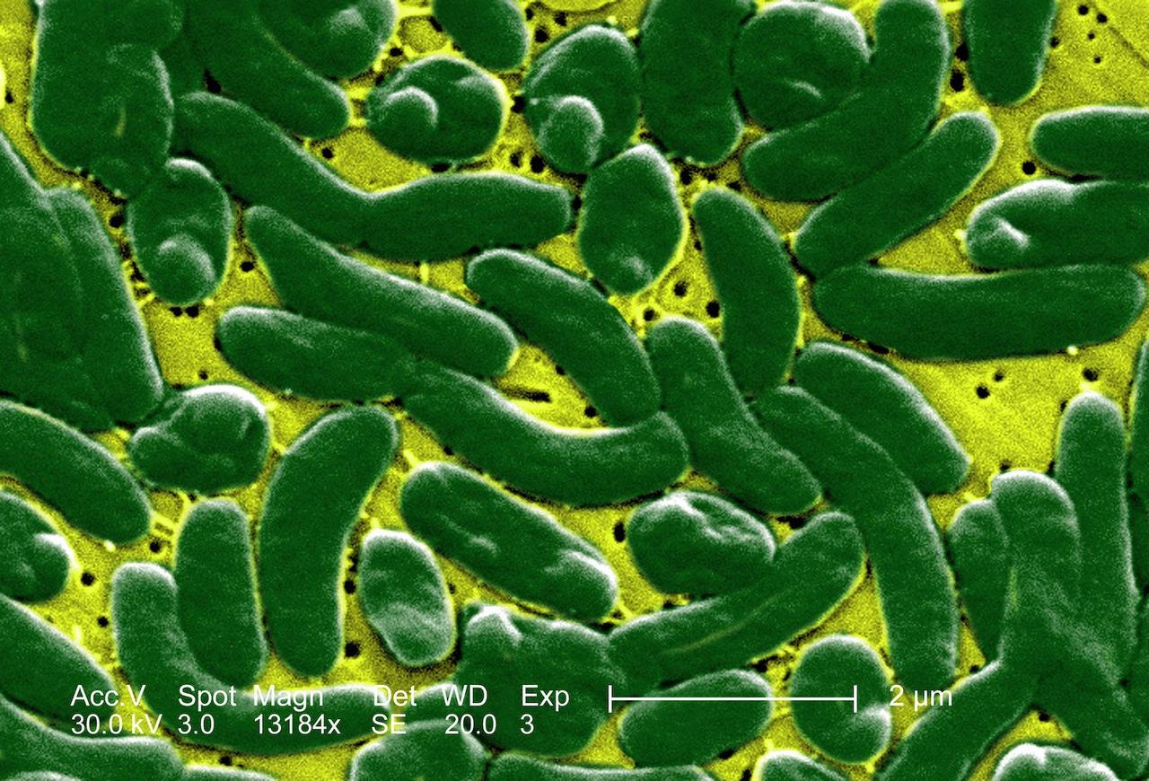 ｢人食いバクテリア｣のビブリオ・バルニフィカス（Vibrio vulnificus）。