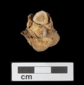 古代エジプト人は病とどう向き合っていたのか…3000年前の遺骨から奇形