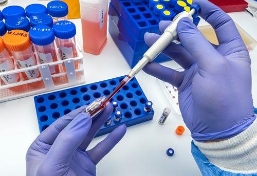長寿研究で次に注目されるのは「臓器年齢」