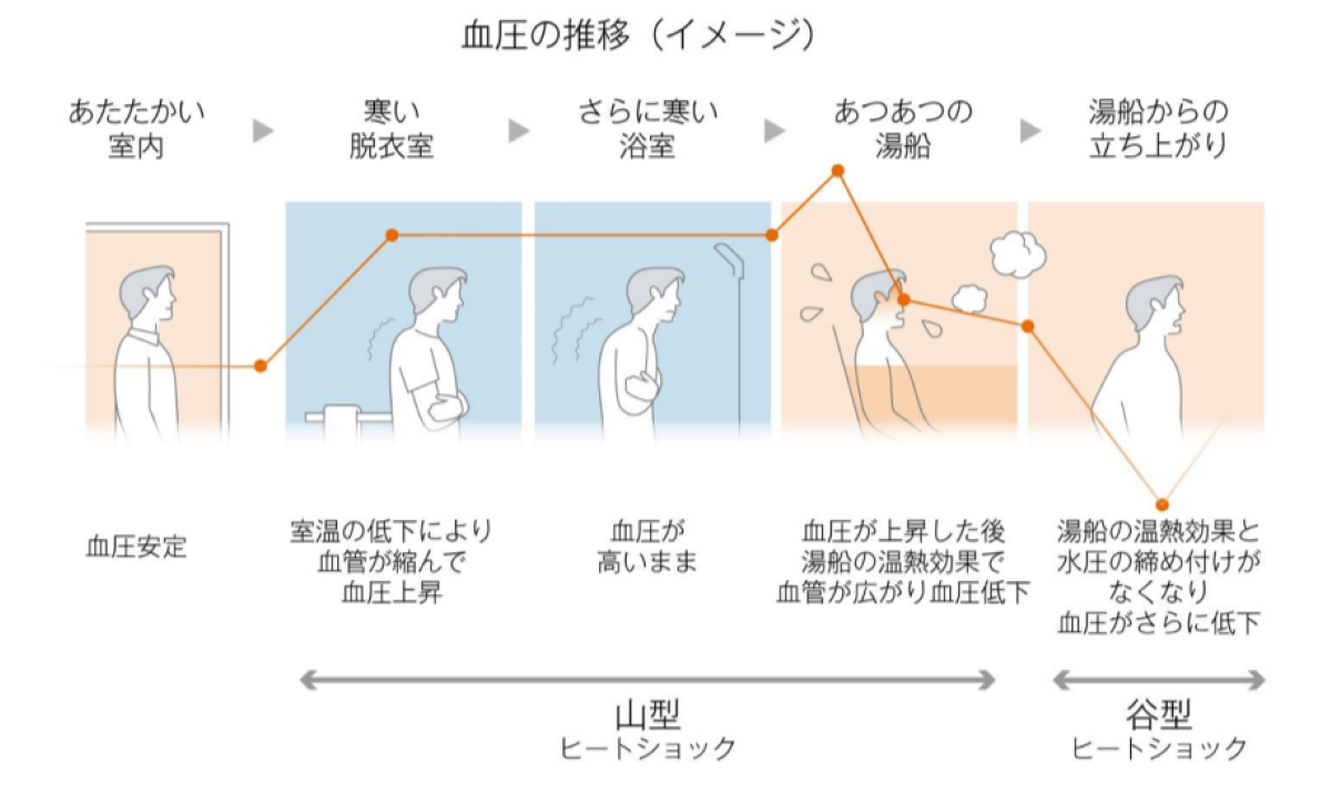 20代の半数以上が“ヒートショック予備軍”。お風呂ドクターによる「冬の危険な入浴方法」10項目 | Business Insider Japan