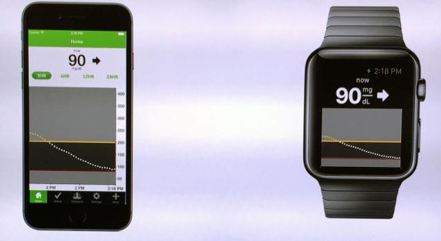 150210apple_watch02.jpg