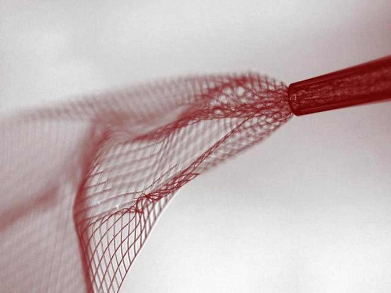 ヒューマンインターネット時代は来るか？ 脳に埋め込むメッシュの人工神経組織