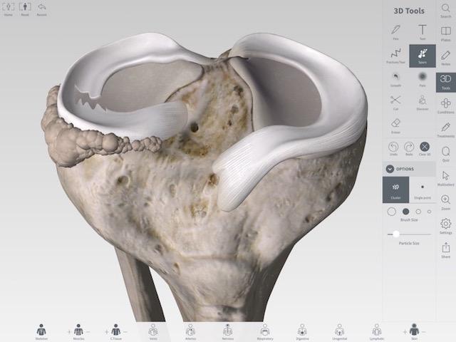 Apple Pencilで自由自在に解剖！ 3D4Medicalの｢Complete Anatomy