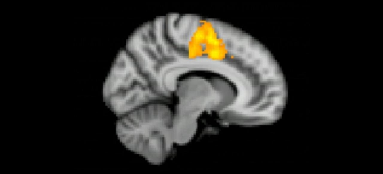 無関心、冷淡、怠け者…その性格には科学的に理由があった