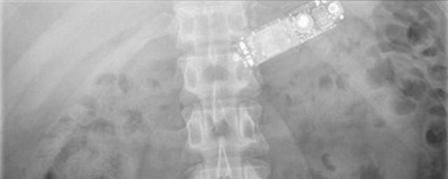 160518Xrayphone.jpg