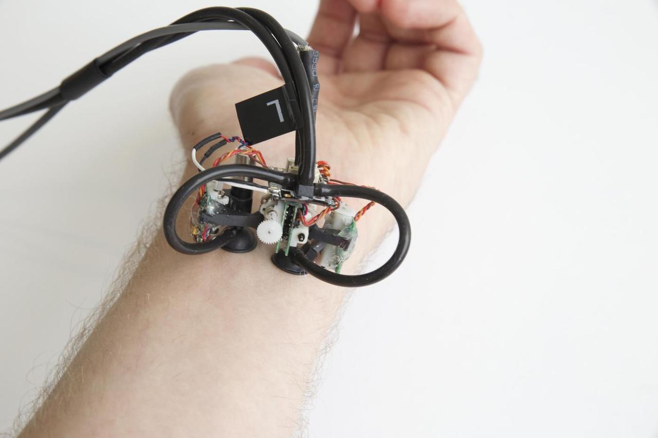 MITが吸引力で肌の上を歩く医療用検査ロボット｢SkinBot｣を開発