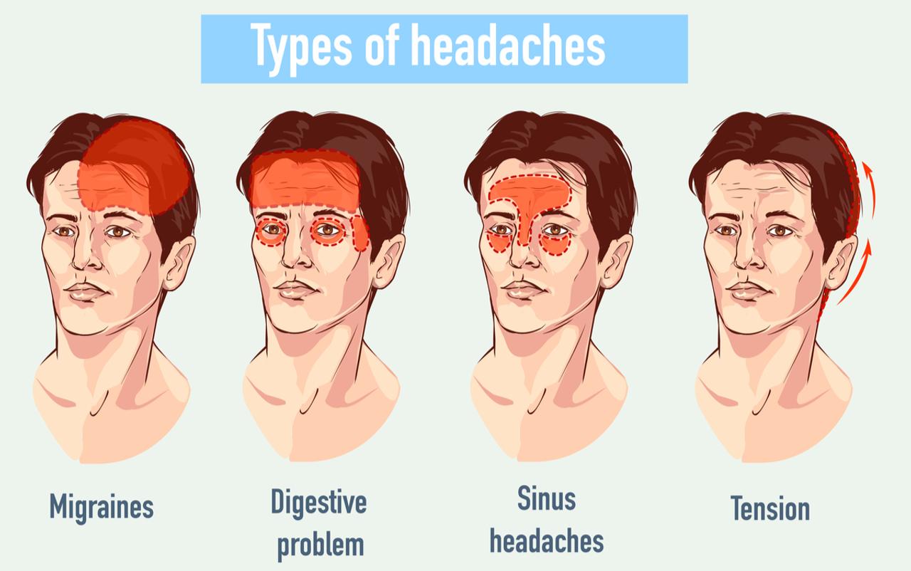 頭痛は300種類以上ある！原因の見極めと正しい対処法 ギズモード・ジャパン