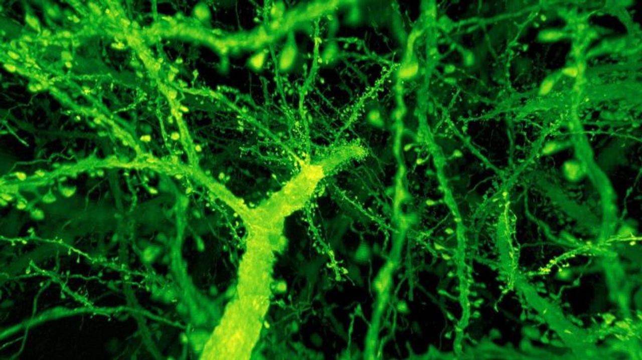 ちいさなハエの脳をリアルに拡大、高解像度で観察する技術