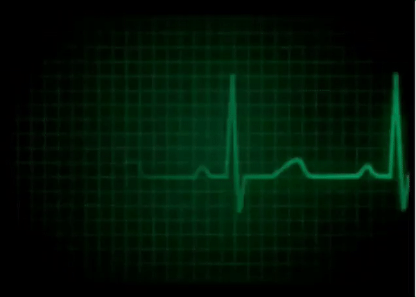 ペンタゴン製｢心臓の鼓動から個人を特定｣する技術。200メートル先から誰だかわかる