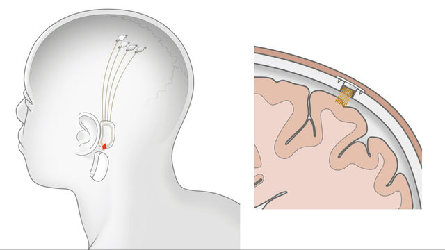 20190717-neuralink-hello-world-05