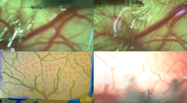 20190717-neuralink-hello-world-08