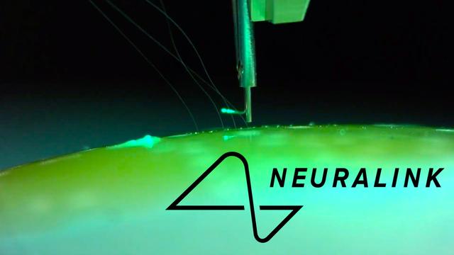 heusc-neuralink