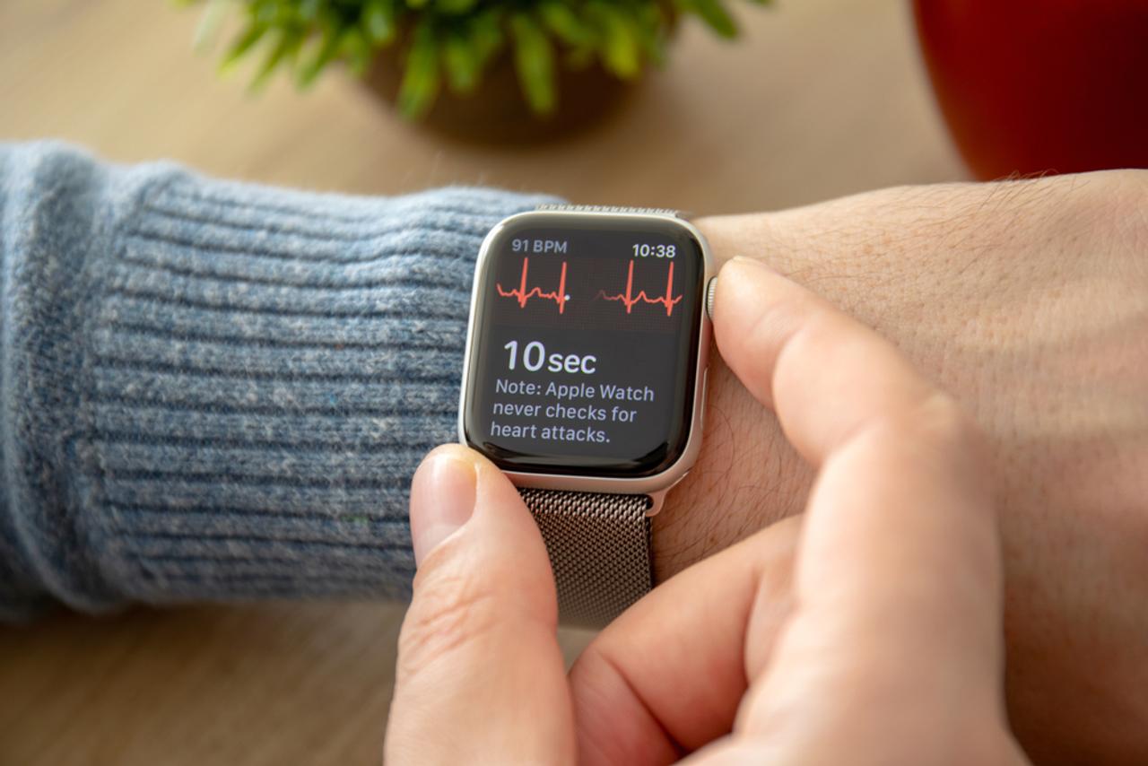Apple Watchの心電図機能、日本での封印解除は近い？