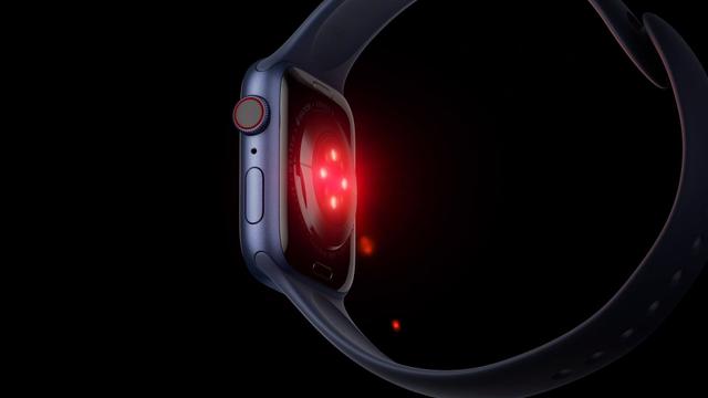血中酸素濃度の計測が可能なセンサーを備えたApple Watch Series 6の画像