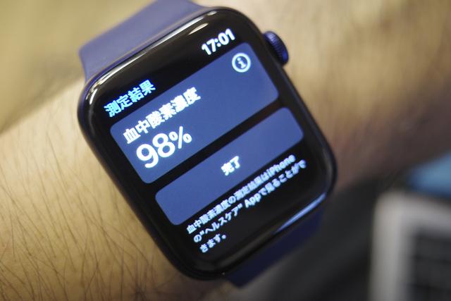 200917applewatchbloodox_08