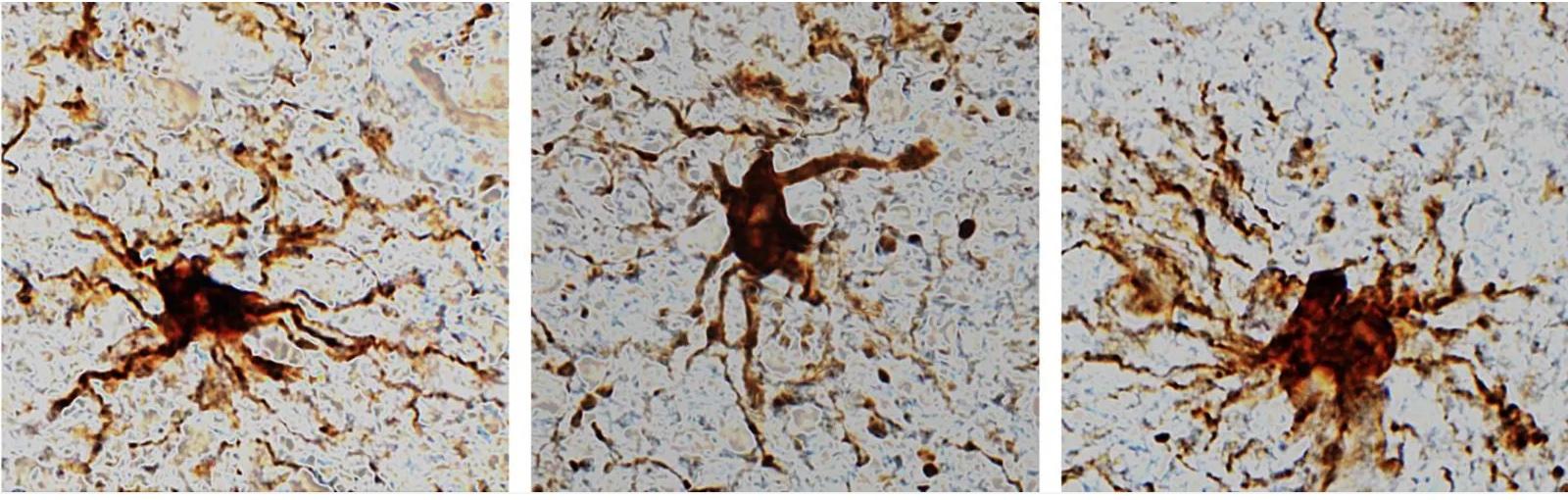 脳細胞のなかには、死後に活性化するものもある」研究結果で明らかに