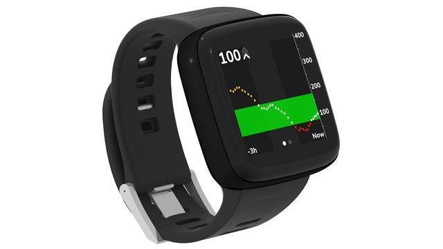 針を刺さずに血糖値が測れちゃうスマートウォッチ、精度良好との試験結果