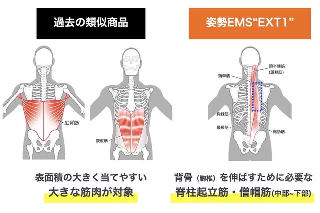 ムリなく姿勢筋トレーニング。新世代EMSなら1日10分で理想の姿勢に 