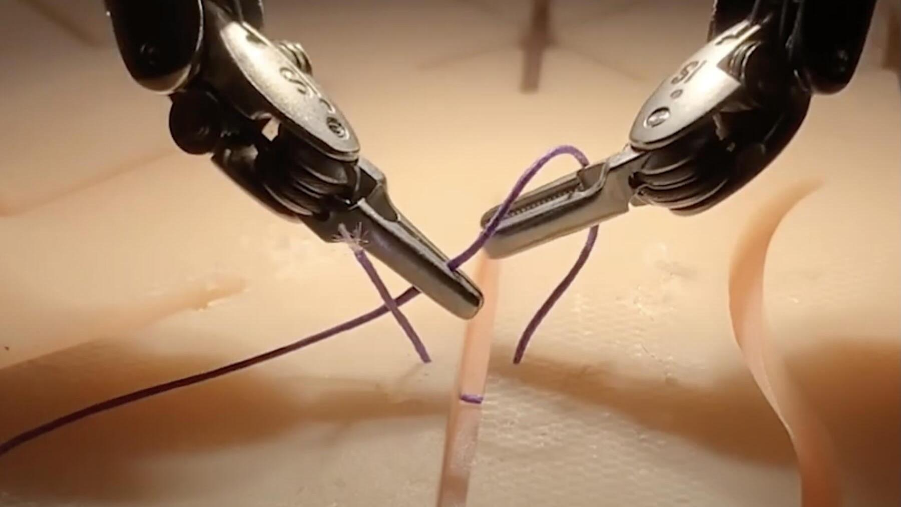 下肢のアドバンスド手術 整形外科医のための下肢のアドバンスト手術 上級医になるために標準