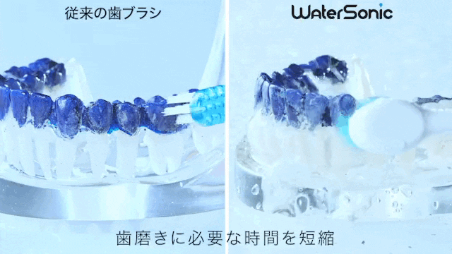 音波振動×ジェット水流」の歯間ケア。歯磨きとフロスの二役こなす 音波振動×ジェット水流」の歯間ケア。歯磨きとフロスの二役こなす