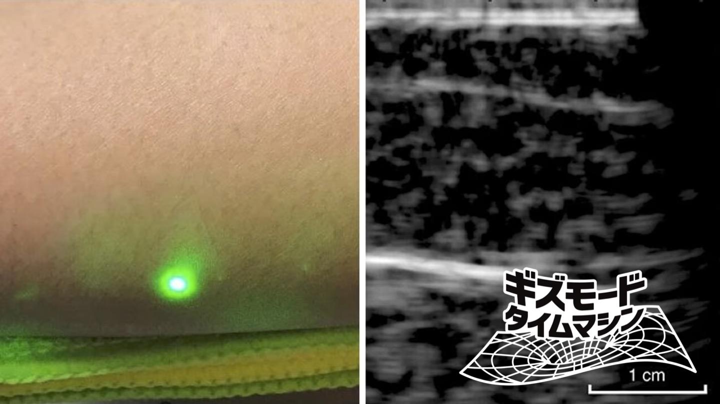 【6年前】結局まだ胃カメラ飲んでるけど。MITがレーザー超音波で体内をのぞいた2019年