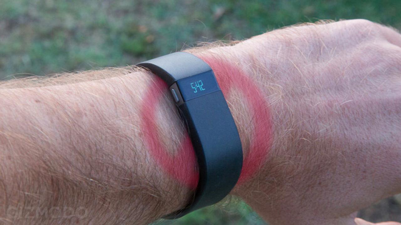 ｢Fitbit Force｣で皮膚かぶれのリコールが発表。ユーザーの方はお気をつけて