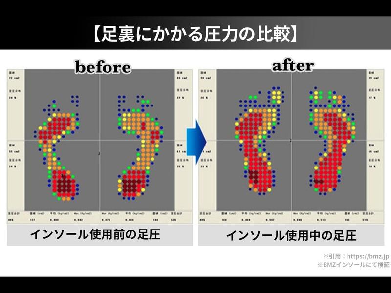 特許技術を採用したインソールでこっそりプラス2.5cm、理想の身長に！ | ライフハッカー・ジャパン