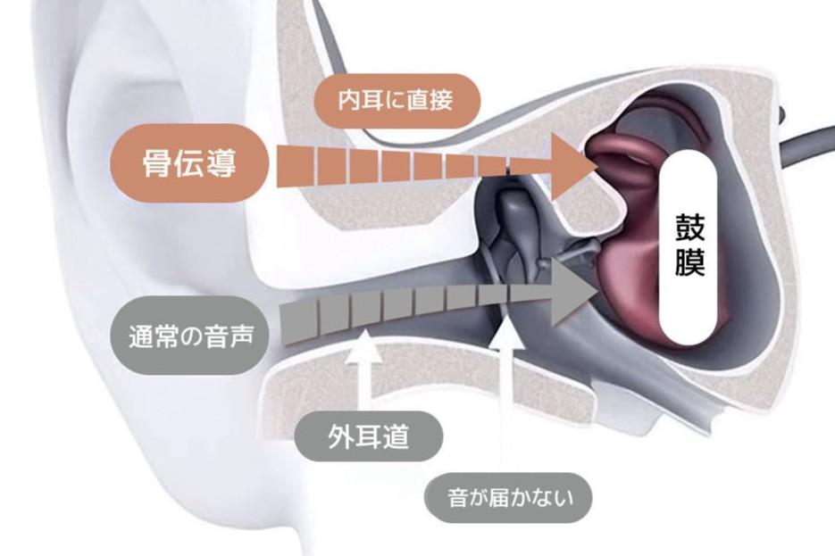 補聴器はまだ早いと感じるあなたへ。耳を塞がない骨伝導イヤホン