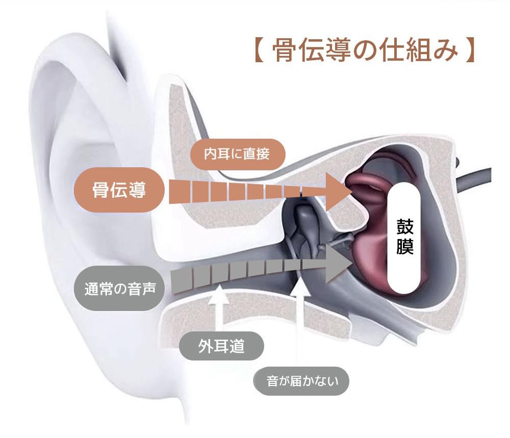 KIKOE Bone 骨伝導ワイヤレスイヤホン Amazon.co.jp: 集音器 骨伝導 コードレスイヤホン 高齢者が使い