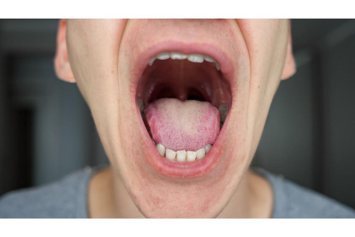 白っぽい？黄色っぽい？ベロの状態で今のコンディションに気づける5秒のセルフチェック