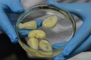 移植可能な腎臓を3Dプリンタで生成、中国の研究者が成功させる