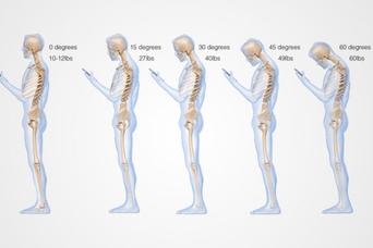 うつむいてのスマホ操作で背骨には30キロ近い負担がある：研究結果
