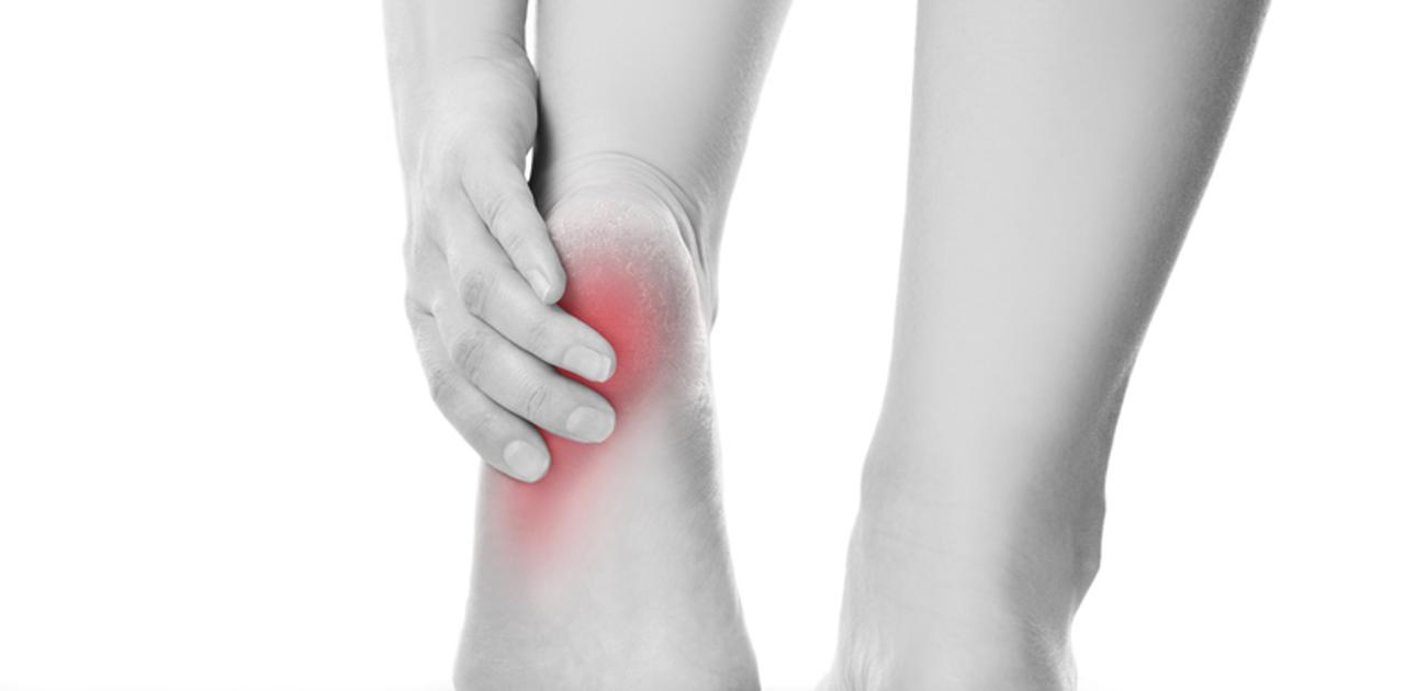 かかとが痛いなら注意 足底筋膜炎 の原因 症状 治癒法 ライフハッカー 日本版 かかとが痛いなら注意 足底筋膜炎 の原因 症状 治癒法 ライフハッカー 日本版