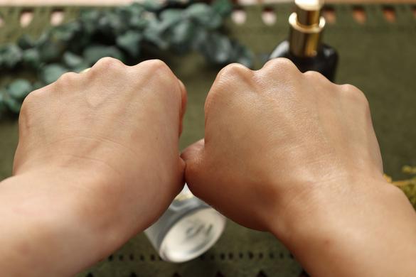 本当に、出会えて良かった。私が「カロミースキン」の化粧水