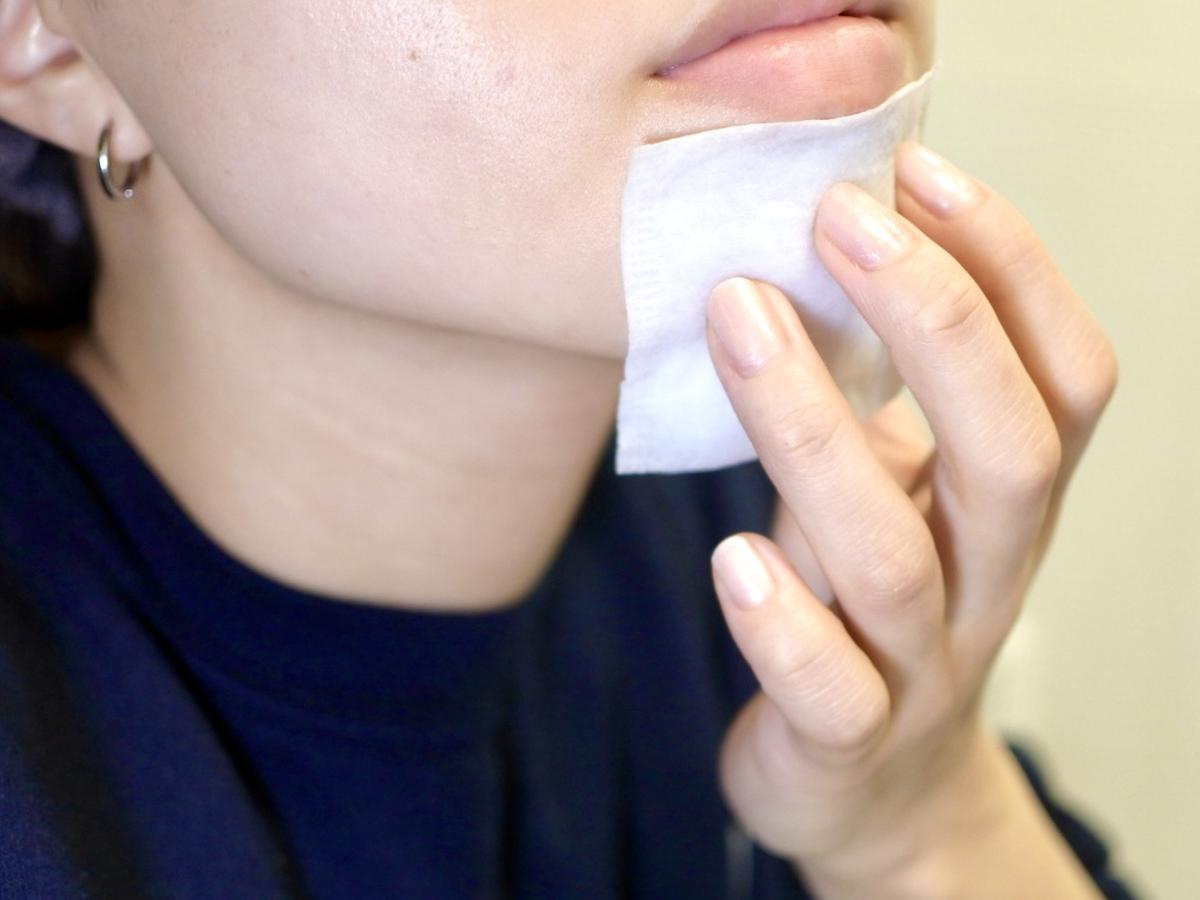 將浸泡過Tuvert「Balancing GA Lotion」的棉花敷在下巴上。