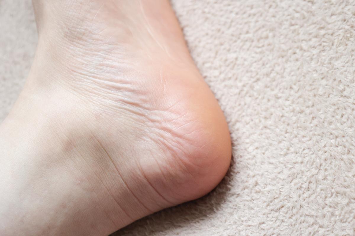 ユースキン「ユースキンAa」