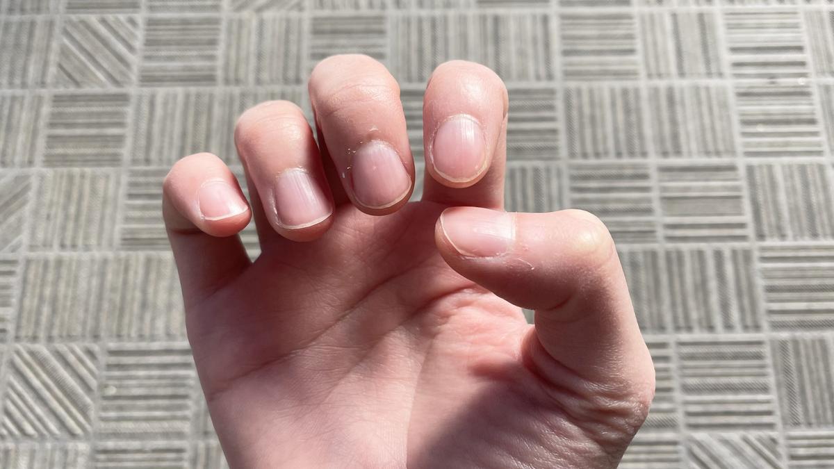 コエンリッチ「薬用エクストラガード ハンドクリーム」