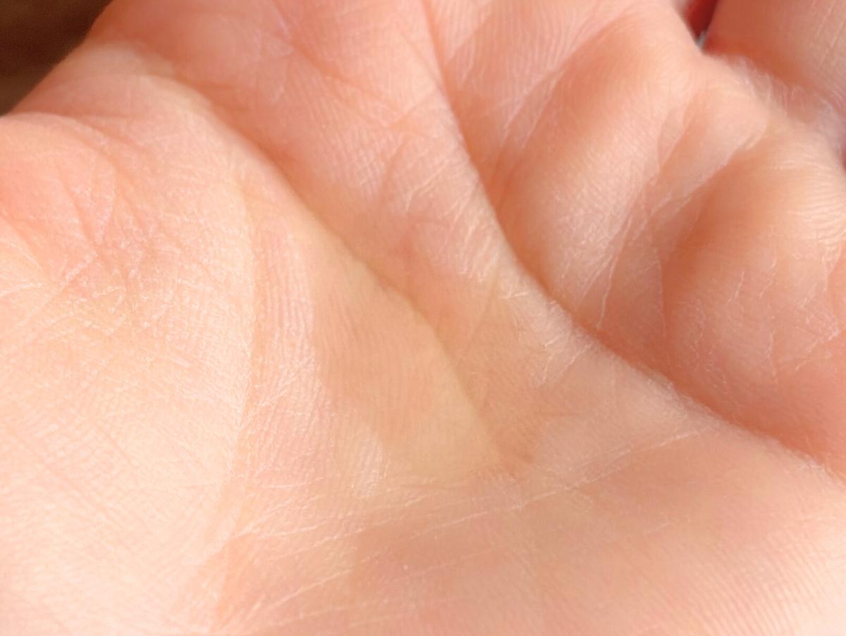 オバジ「C5セラム」の1回あたりの使用量3～4滴分を手のひらに出した様子