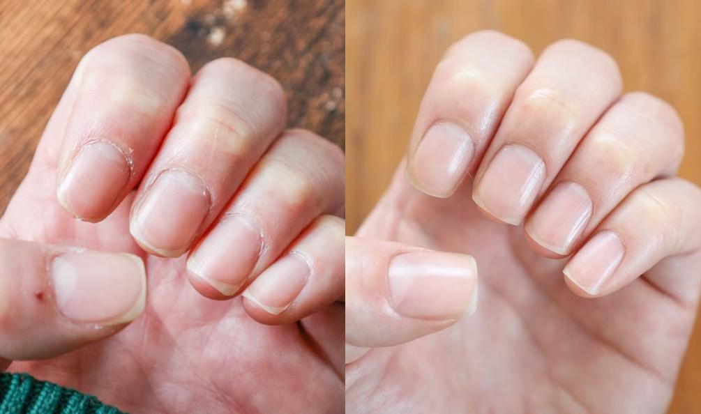 爪にコンプレックスがあった私。約1ヶ月間、HEATHの「ネイルオイル」で